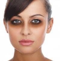 girl with dark circles