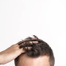 non-surgical hair replacement