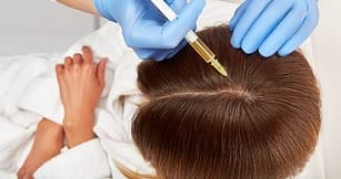 hair loss